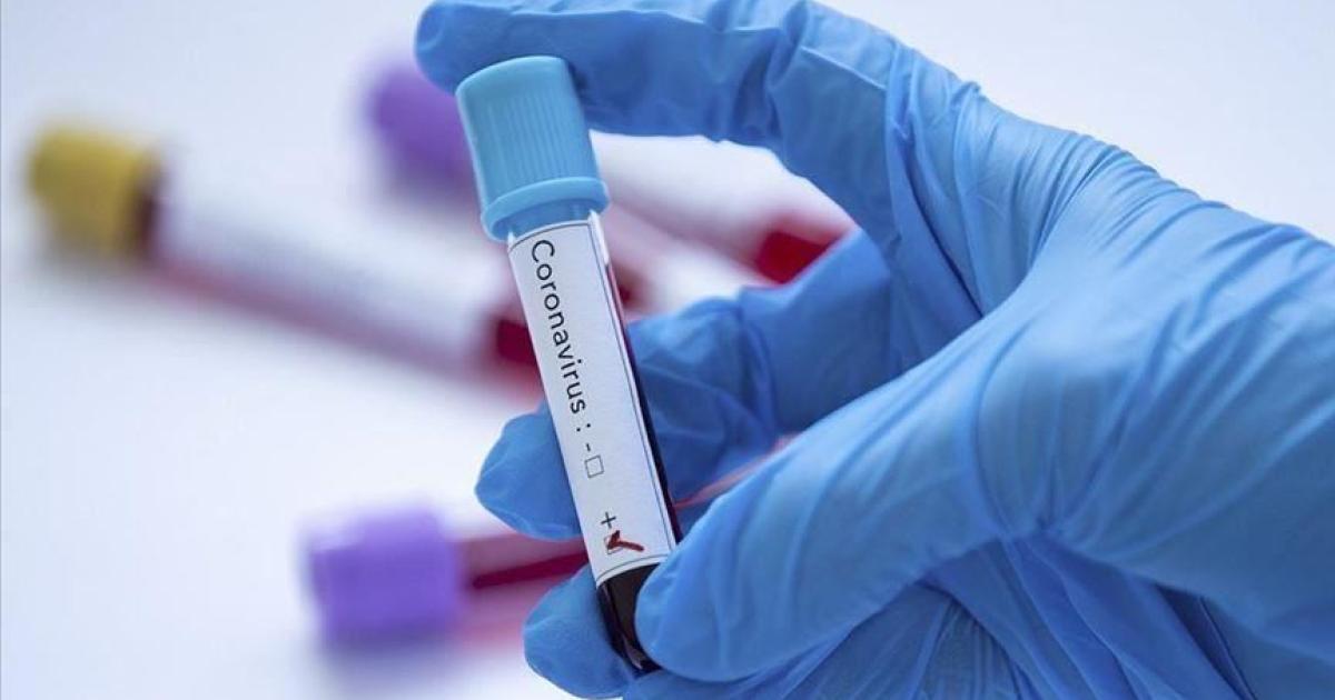Coronavirus