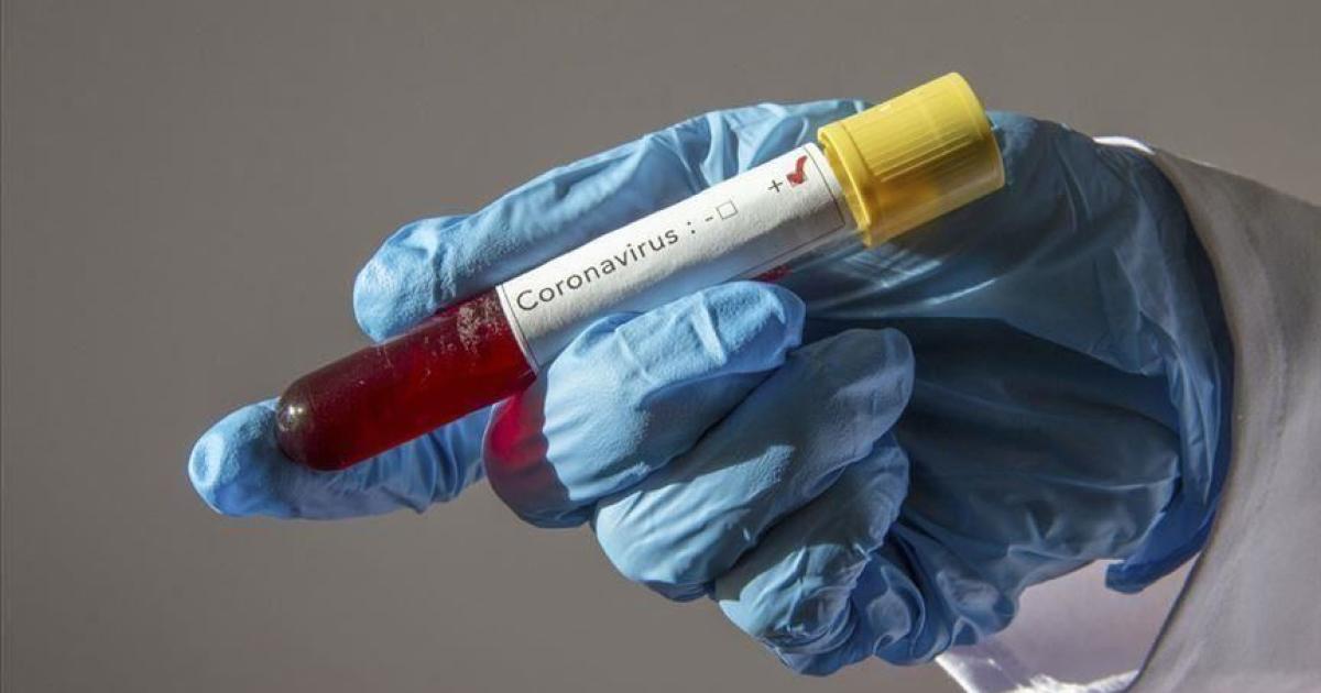 Coronavirus