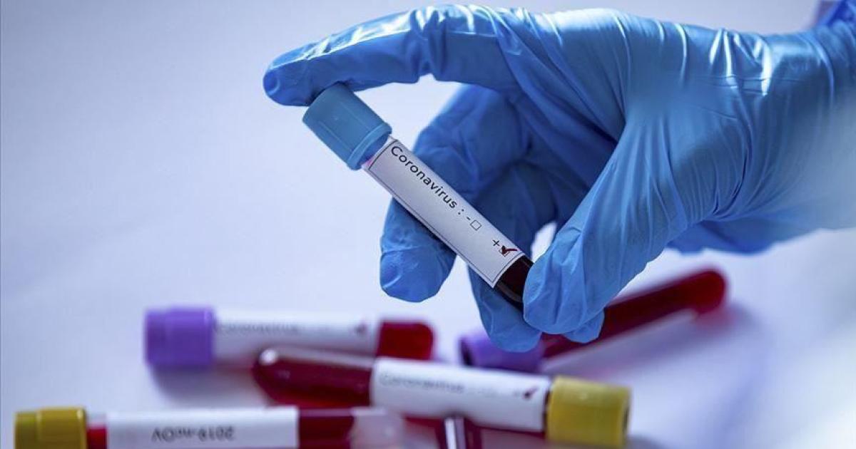 Coronavirus