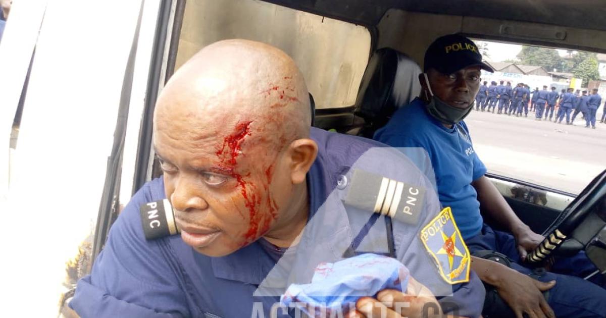 Un affocier de la police blessé par projectile lors de la manifestation des militants de l'UDPS à Kinshasa contre le choix de Malonda comme président de la CENI/Ph ACTUALITE.CD