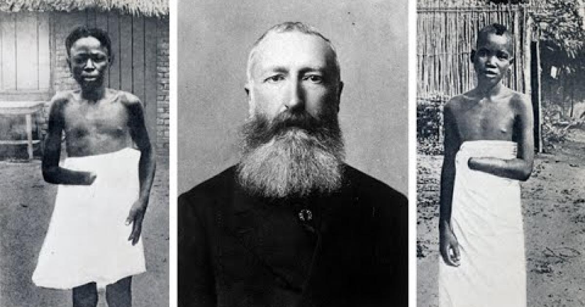 Léopold II au milieu de deux congolais amputés. 