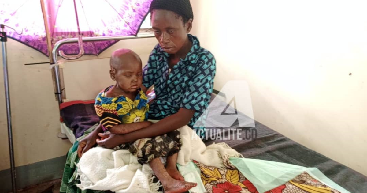 Prise en charge d'un enfant touché par la rougeole dans la zone de santé de Mulumba (Lomami)