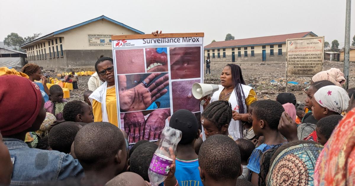 Séance de sensibilisation contre M-Pox. Ph.MSF