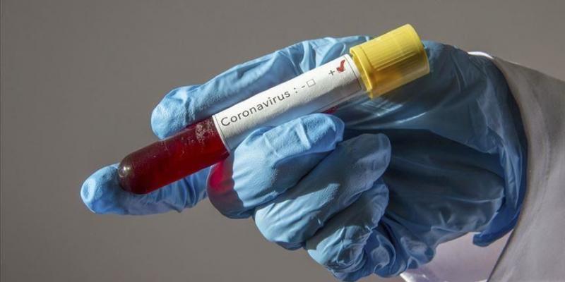 Coronavirus