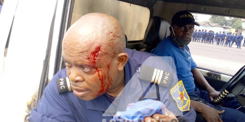 Un affocier de la police blessé par projectile lors de la manifestation des militants de l'UDPS à Kinshasa contre le choix de Malonda comme président de la CENI/Ph ACTUALITE.CD