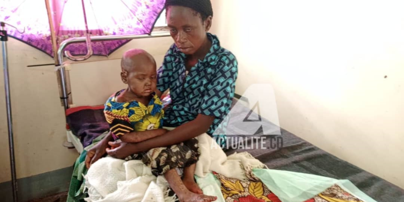 Prise en charge d'un enfant touché par la rougeole dans la zone de santé de Mulumba (Lomami)