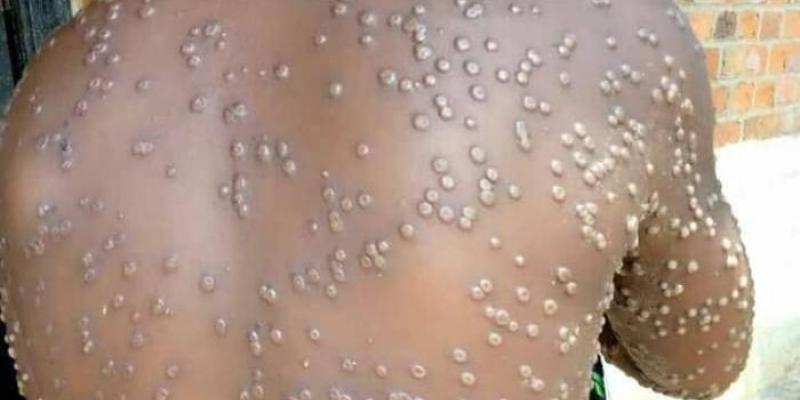 Photo d'illustration