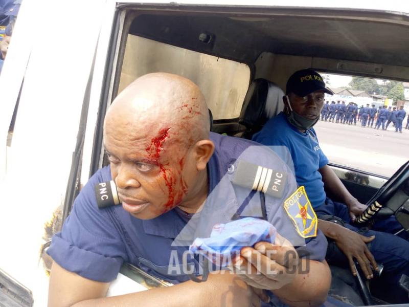 Un affocier de la police blessé par projectile lors de la manifestation des militants de l'UDPS à Kinshasa contre le choix de Malonda comme président de la CENI/Ph ACTUALITE.CD