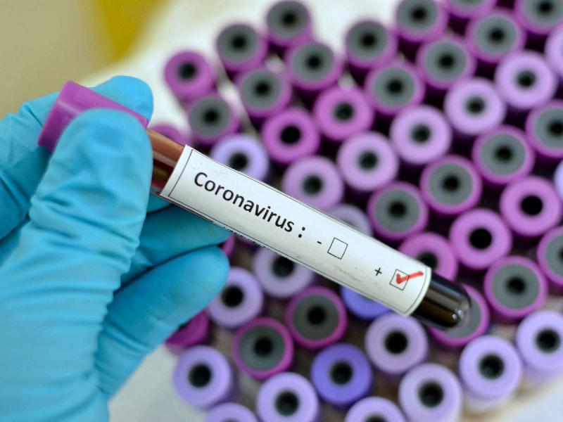 Visuel Coronavirus 
