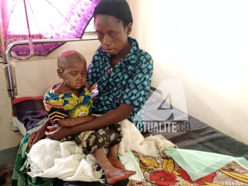 Prise en charge d'un enfant touché par la rougeole dans la zone de santé de Mulumba (Lomami)