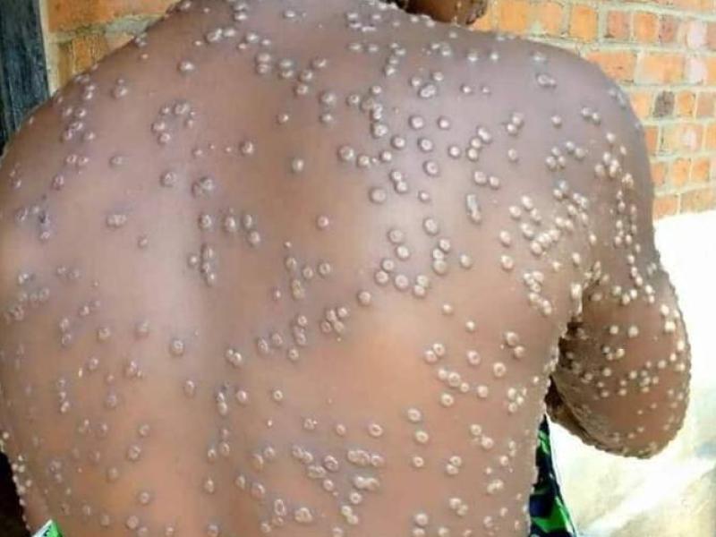 Photo d'illustration